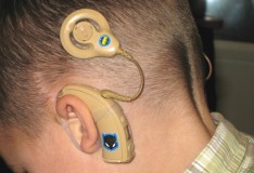 Cirurgia do ouvido biônico é tema de curso na OSID
