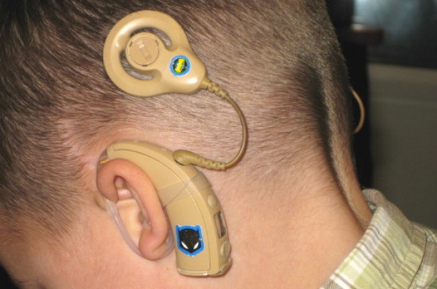 Cirurgia do ouvido biônico é tema de curso na OSID